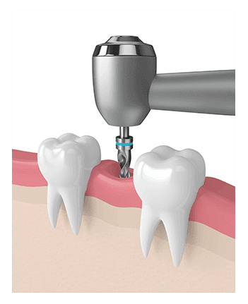 אסתטיקה דנטלית