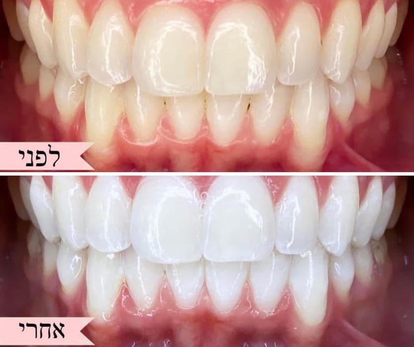 לפני