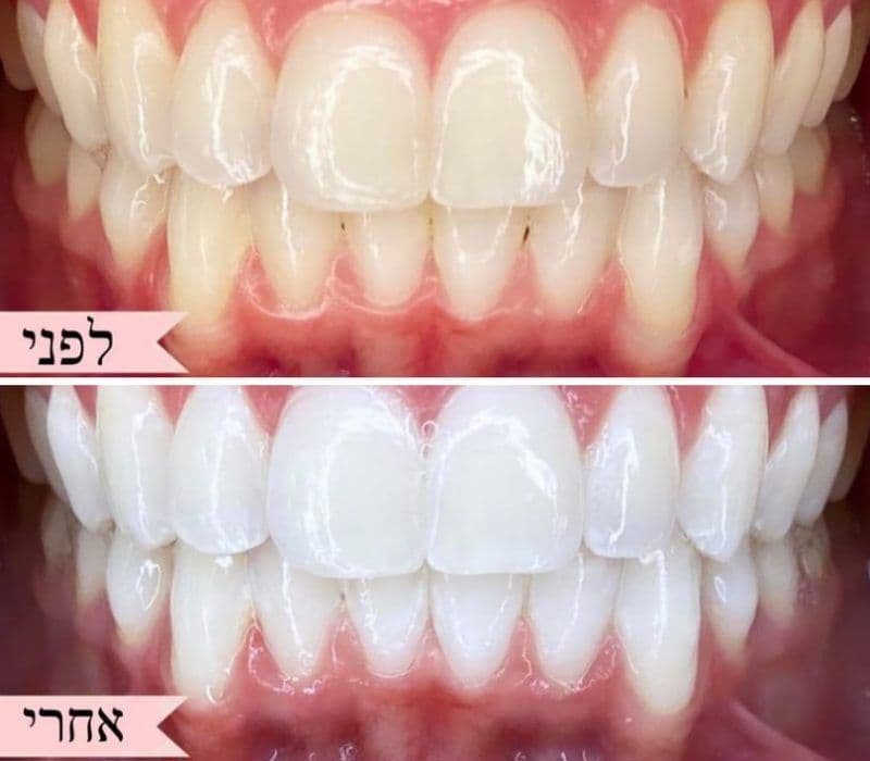 אחרי
